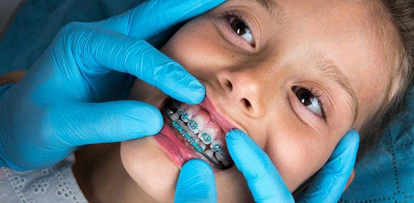 Aparelho para crianças - Unique Smile