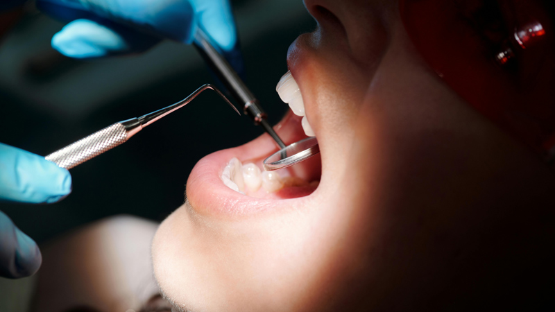 Restauração dentéria | Unique Smile