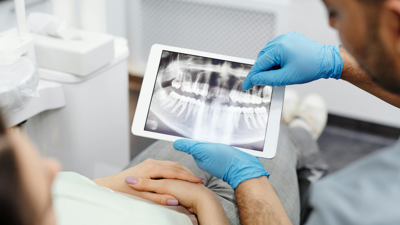 Unique Smile - Endodontia, desvitalização do dente