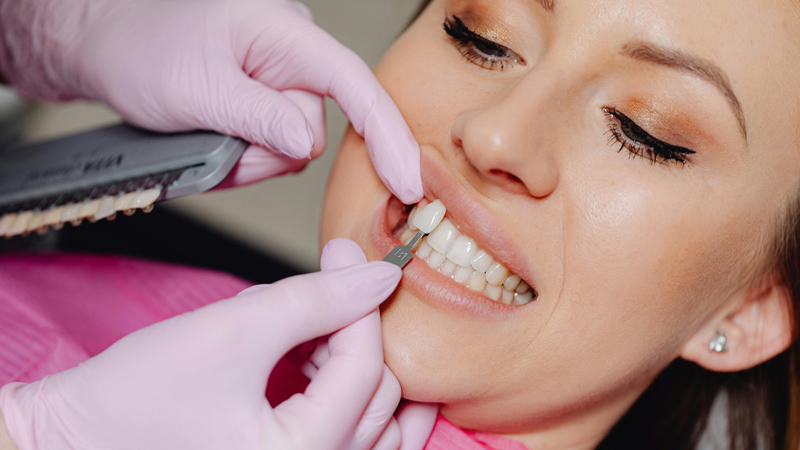 unique smile-prostodontia, reconstrução do dente